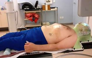 Jean-Pierre Mille allongé sur la table de radiothérapie pendant une séance de rayons.